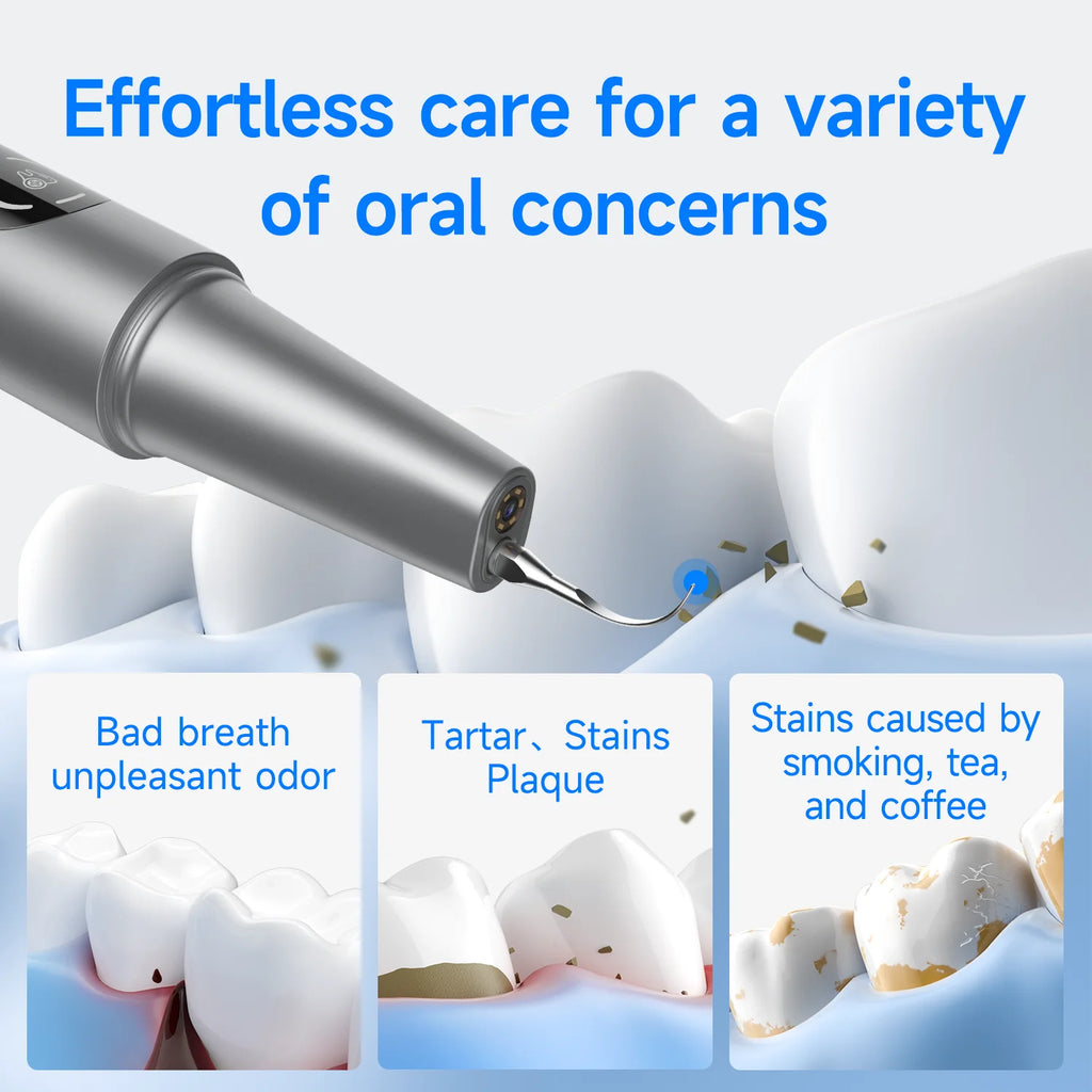 CURVY MOON Visible Electric Ultrasonic Tooth Cleaner with Camera Tartar Remover Tooth Stain Cleaning Tools Teeth Whitening Care